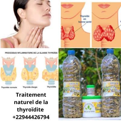 Comment soigner la Thyroïdite? Traitement naturel de la thyroïdite