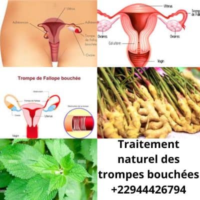 Comment déboucher les trompes naturellement au Sénégal?