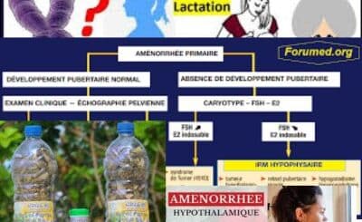 Comprendre l´aménorrhée: Traitement 100 % Naturel de l´aménorrhée