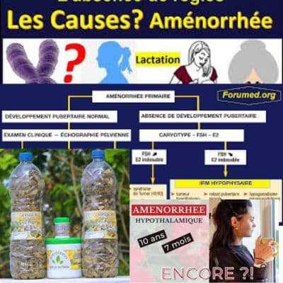 Comprendre l´aménorrhée: Traitement 100 % Naturel de l´aménorrhée