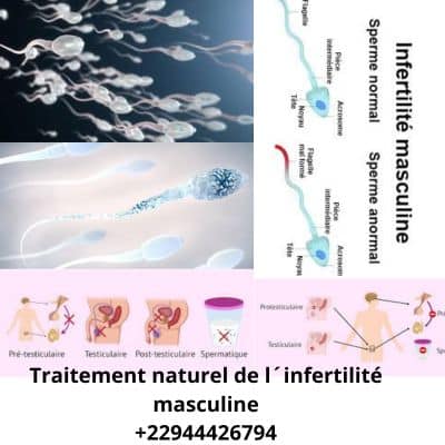 Infertilité masculine: Traitement 100 % naturel de l´infertilité masculine