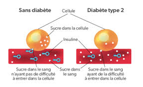 Comment soigner le Diabète? Traitement 100% naturel du diabète