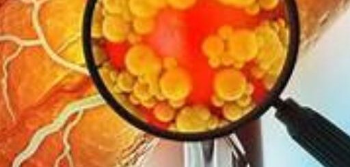 Solution naturelle contre la NASH