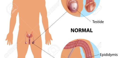 Hydrocèle testiculaire Solution Naturelle