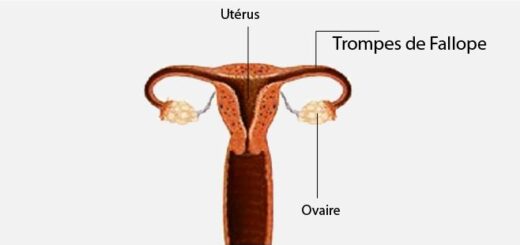 Traitement de l'Endométriose et Fertilité