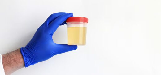 Infection Urinaire Récidivante Que Faire